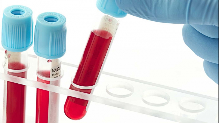 Ce boli poţi dezvolta în funcţie de grupa ta de sânge 