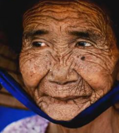 O bătrână de 100 de ani i-a rugat pe specialişti să o facă din nou tânără 