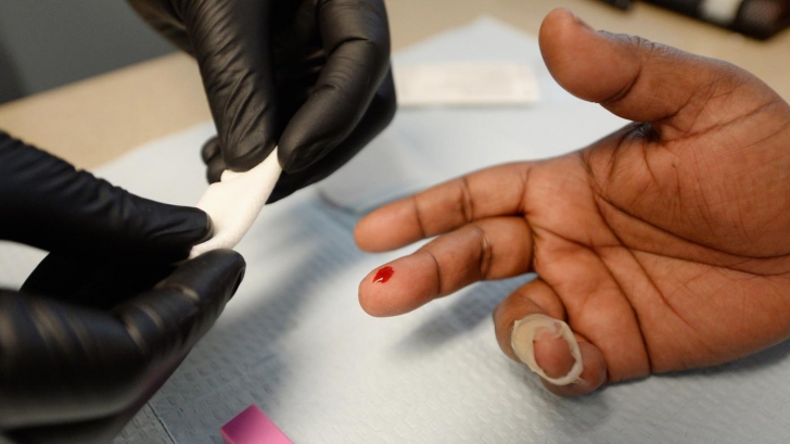 Şase semne surprinzătoare care îţi spun că ai virusul HIV