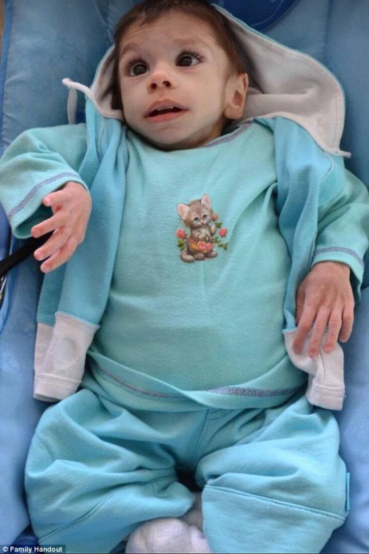 Transformare incredibilă a unui orfan din Bulgaria, după ce a fost ADOPTAT. La 7 ani, avea 3 kg