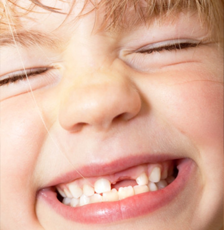 Atenţie, părinţi! De ce să nu aruncaţi dinţii de lapte ai copiilor: le-ar putea salva viaţa!