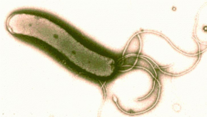 Leguma care omoara bacteria helicobacter pilori, cea care cauzeaza ulcerele