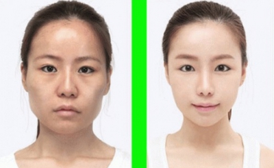 "Minunile" chirurgiei estetice. Cele mai provocatoare intervenţii - transformările, uluitoare!