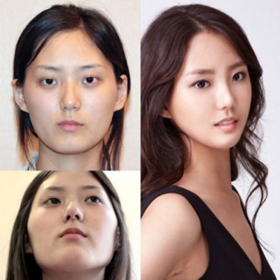 "Minunile" chirurgiei estetice. Cele mai provocatoare intervenţii - transformările, uluitoare!