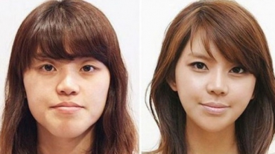 "Minunile" chirurgiei estetice. Cele mai provocatoare intervenţii - transformările, uluitoare!