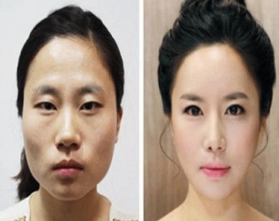 "Minunile" chirurgiei estetice. Cele mai provocatoare intervenţii - transformările, uluitoare!