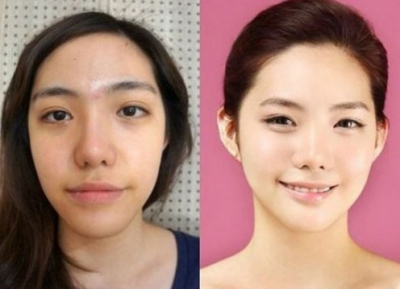 "Minunile" chirurgiei estetice. Cele mai provocatoare intervenţii - transformările, uluitoare!