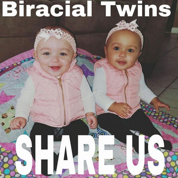 Fotografiile unor gemene au devenit virale, pentru că nimeni nu crede că sunt surori!