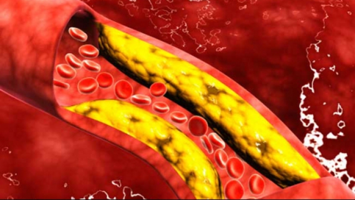 Cum îţi poţi curăţa vasele de sânge de colesterol în doar 40 de zile