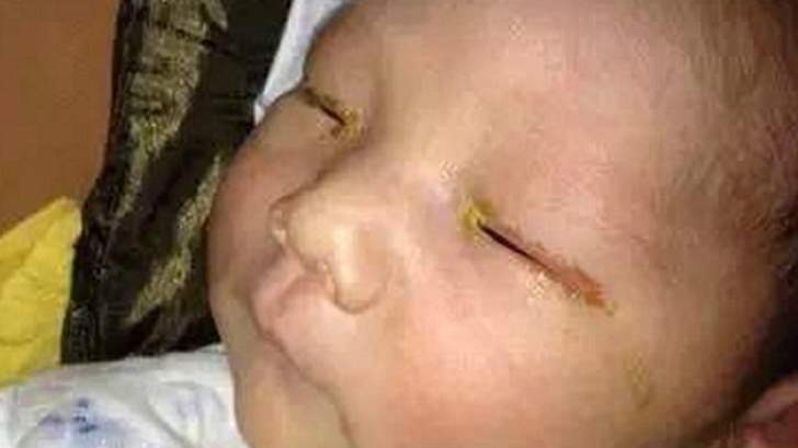 Un bebeluș a orbit din cauza blițului de la camera foto. Cum explică medicii tragedia