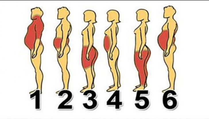 Identifică-ţi tipul de obezitate pentru a scapa rapid de kilogramele în plus 
