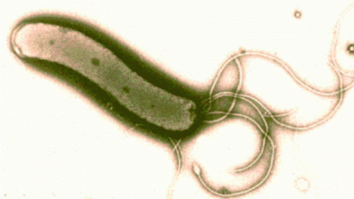 Leguma care omoară bacteria helicobacter pilori, cea care cauzează ulcerele