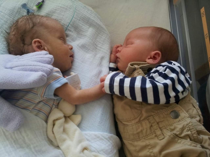 Tulburător: ce reacţie are un bebeluş în stare critică când îl pun pe fratele geamăn alături de el