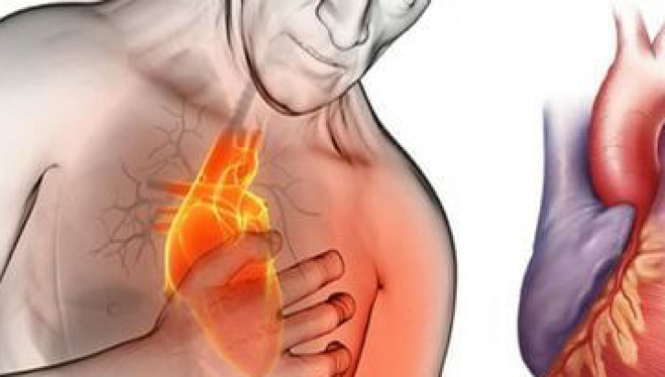 Cum să opreşti atacul de cord în 60 de secunde cu un singur ingredient 