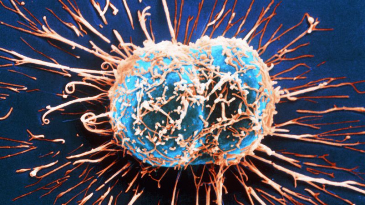 Ce declanșează apariția și răspândirea cancerului în organism? Oamenii de știință au o nouă teorie