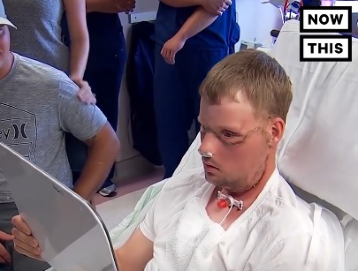 Un glonţ i-a distrus faţa. După 10 ani, bărbatul a primit un chip nou! Dovada că minunile există! / Foto: captura video