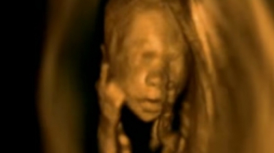 Ce fac bebeluşii &icirc;n burtica mamei. Imagini inedite