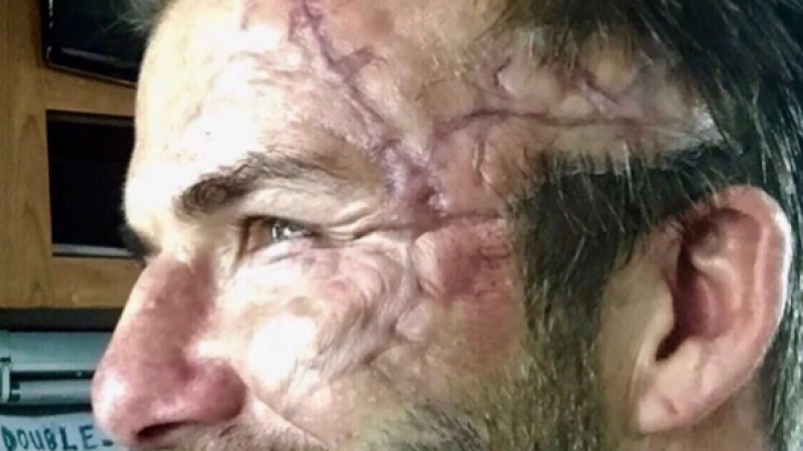 Apariţie ÎNFIORĂTOARE a lui David Beckham, plin de cicatrici pe faţă. Ce a păţit
