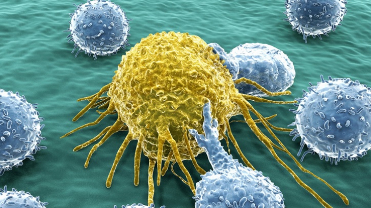 De ce apare cancerul și la oamenii care au o viață sănătoasă. Ți se face pielea de găină