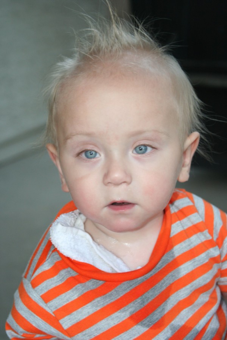 Acest micuț a suferit 65 de operații din cauza unui lucru mic, care se găsește în fiecare casă