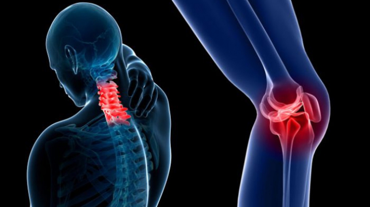 deformarea osteoartrozei articulației șoldului tratament de 2 grade articulațiile crunch doare în tot corpul