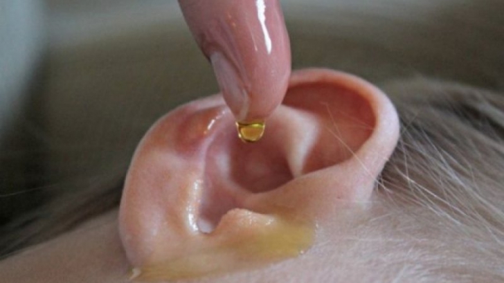 Ce se întâmplă dacă torni o picătură de oţet în ureche 