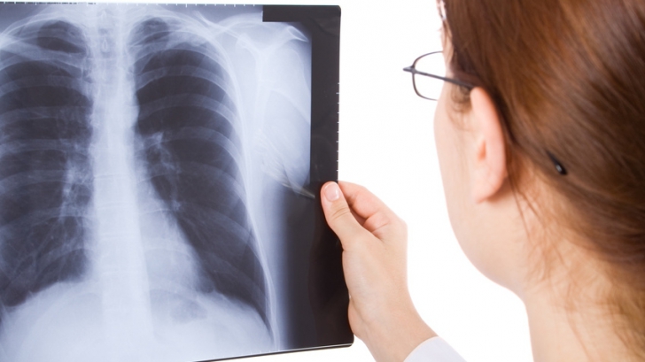 Beneficiile şi riscurile radiografiei! La ce interval de timp putem repeta procedura