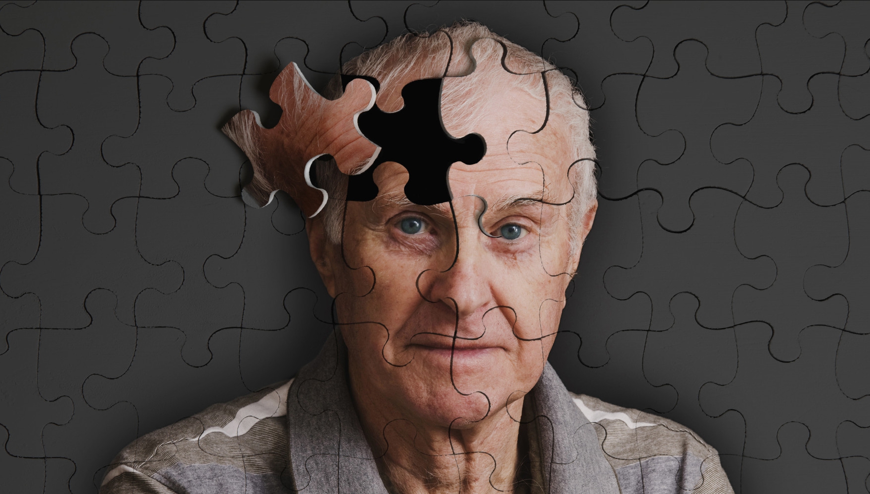Un om din 5 poartă ar putea fi imun la Alzheimer și Parkinson. Care este explicația – studiu revoluționar