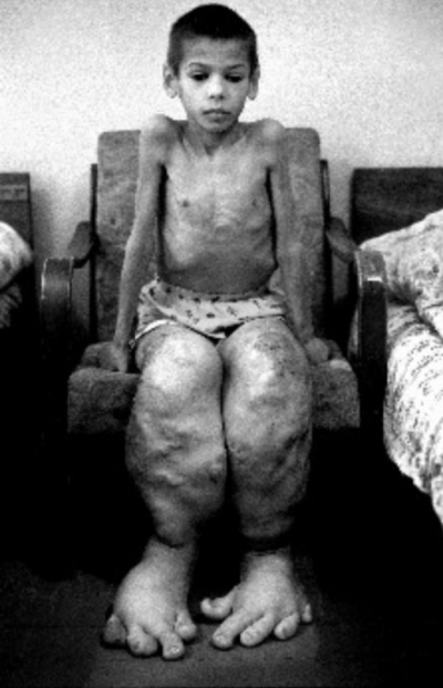 31 de ani de la dezastrul de la Cernobîl. Cele mai şocante imagini cu consecinţele catastrofei