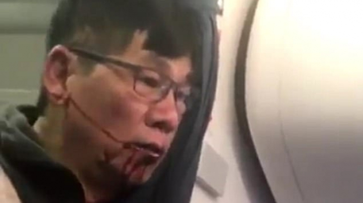 Cine era, de fapt, pasagerul bătut de angajații United Airlines. Nimeni nu se aștepta