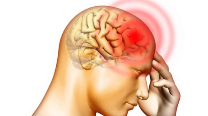 Primele simptome ale cancerului la creier sunt banale dureri de cap. E un tip de cancer devastator