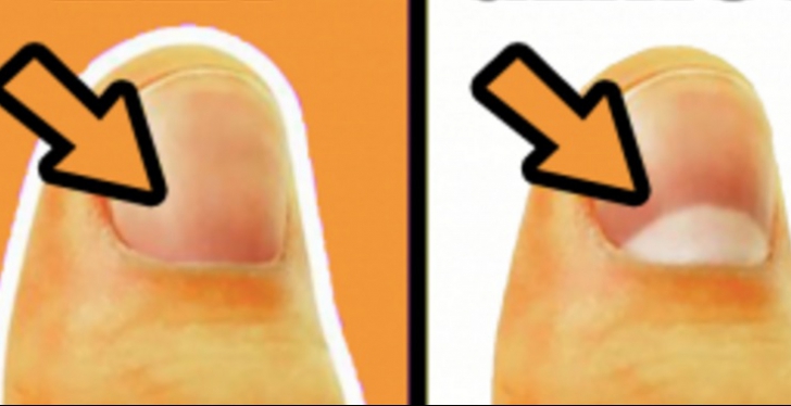 Ştiaţi ce reprezintă semiluna de la baza unghiilor? Dacă dispare de la degetul mare, e PERICOL