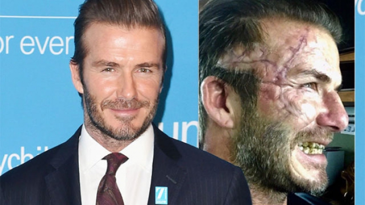 Dezvăluiri CUTREMURĂTOARE: David Beckham are probleme psihice