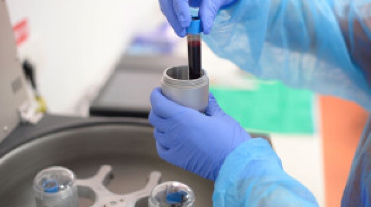 Vindecarea cu ajutorul propriului sânge, o revoluție în medicină. Ce e tehnologia PRGF