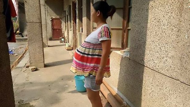 Caz șocant! O femeie este însărcinată de 18 luni! De ce nu iese copilul din burtă