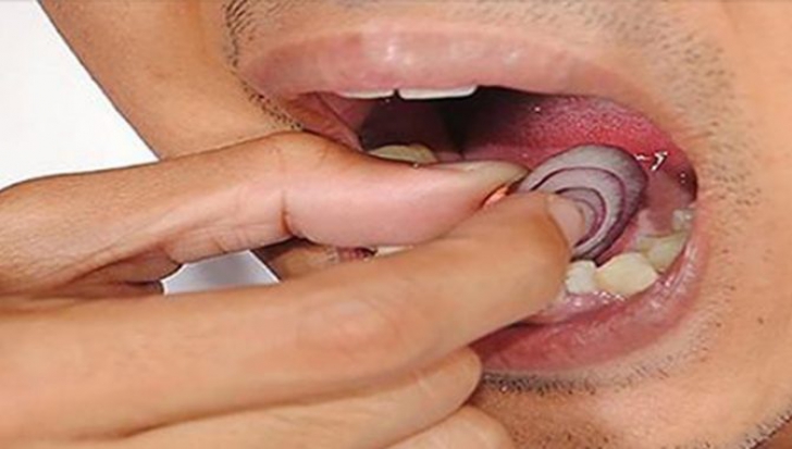 Suferi de dureri groaznice de dinţi? Iată cum te poate scăpa ceapa de o vizită la medicul dentist