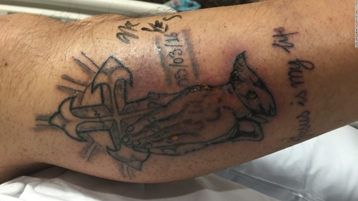 Un tânăr a murit după ce şi-a tatuat un mesaj pe picior. Ce conţinea vopseaua