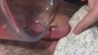 A simțit că i se mișcă ceva în ureche și a cerut ajutorul prietenilor. Ce a urmat este ÎNGROZITOR