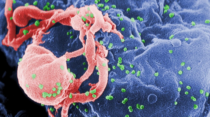 De unde provine virusul HIV şi cum au apărut primele cazuri