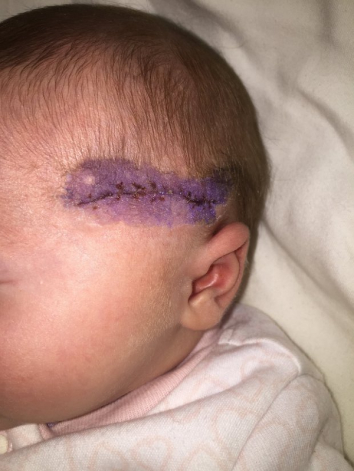 Caz șocant! Medicul a tăiat capul bebelușului în timpul operației de cezariană