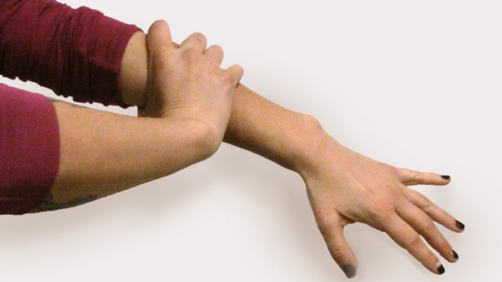 durere în antebraț soiuri de artroză a articulației genunchiului și tratament
