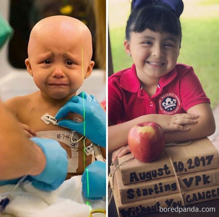"Am învins cancerul!". 10 fotografii care te vor face să plângi