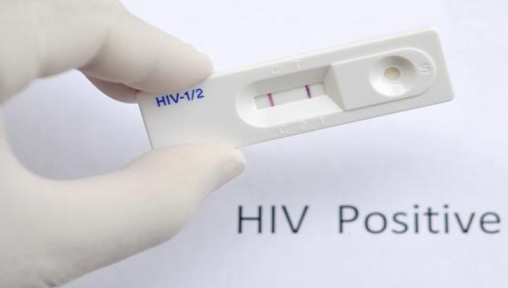 Primul test pentru HIV care poate fi făcut acasă. Funcționează pe baza unei probe de salivă