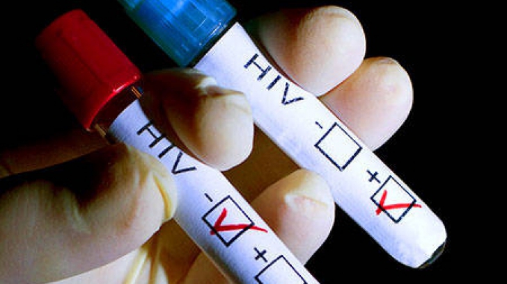 Primul test pentru HIV care poate fi făcut acasă. Funcționează pe baza unei probe de salivă