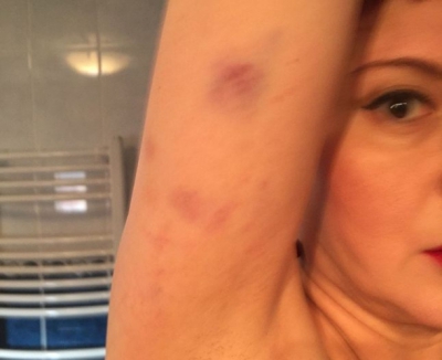 INCREDIBIL! O jurnalistă a fost agresată de polițiști: ”Am vânătăi pe tot corpul”