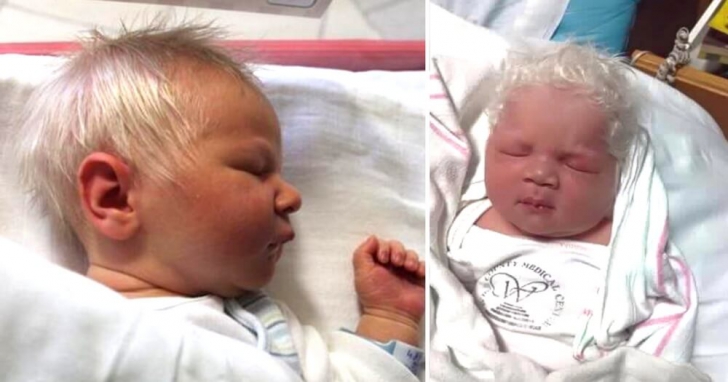 Părinţii au avut un ŞOC când au văzut bebeluşul: s-a născut cu părul complet alb. Care e motivul