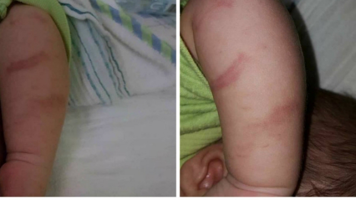 Imagini revoltătoare: Bebeluş învineţit de medici: S-au chinuit 30 de minute să...