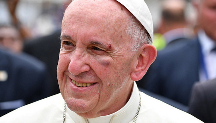 Papa Francisc, implicat într-un accident în ultima zi de vizită în Columbia