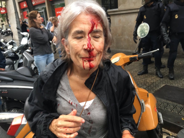 Referendum în Catalonia marcat de violenţe. 844 de răniţi, după ciocniri între Poliţie şi votanţi