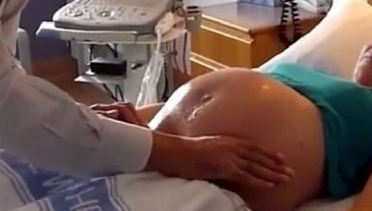 Expusă radiațiilor în timpul sarcinii, credea că totul va fi bine. Ce a născut la final..e terifiant
